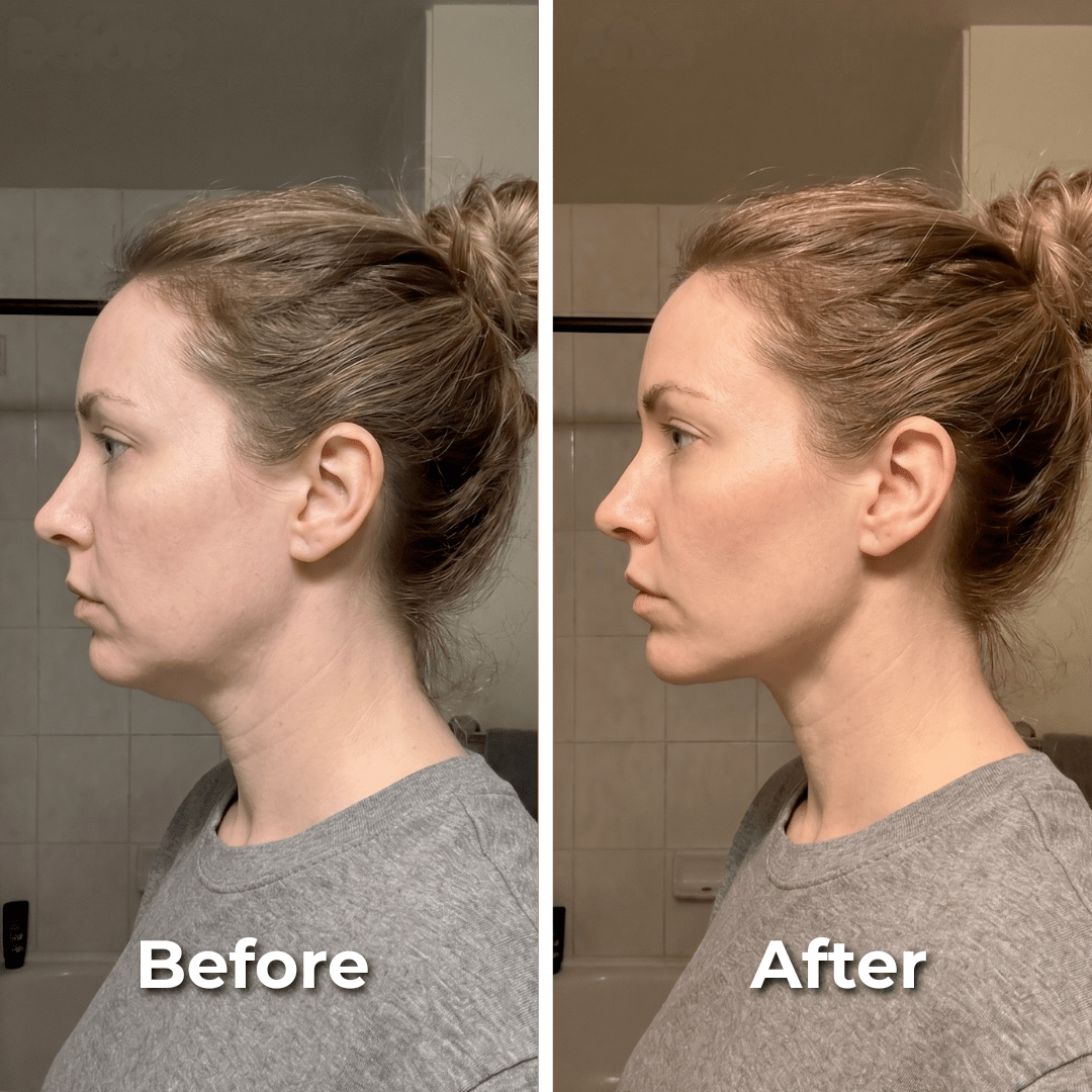 Zena Lymphatic Face Brush